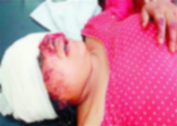 family accident 6 injured