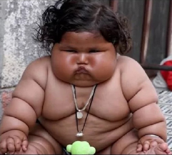 9 ਮਹੀਨਿਆ ਦੀ ਬੱਚੀ ਦੇ ਦੇਖੋ ਕੀ ਹੋ ਗਿਆ ਹਾਲ, ਹੁਣ ਮਿਲੇਗੀ ਨਵੀਂ ਜ਼ਿੰਦਗੀ! (ਤਸਵੀਰਾ)