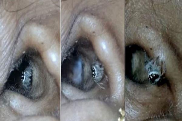 the pain of the woman being in the ear