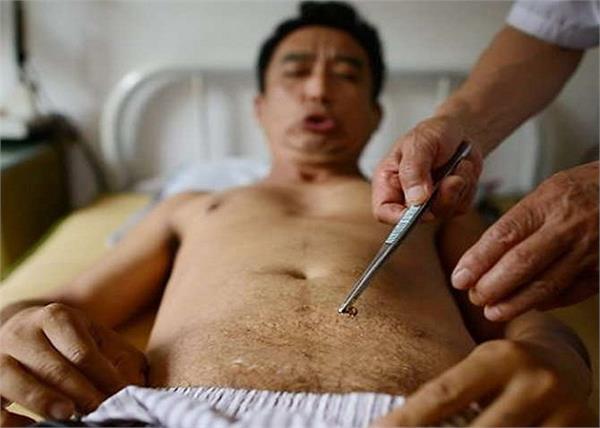 you will be surprised to know these dangerous methods of treating in china