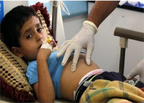 yemen   un warns on the issue of cholera  1300 deaths