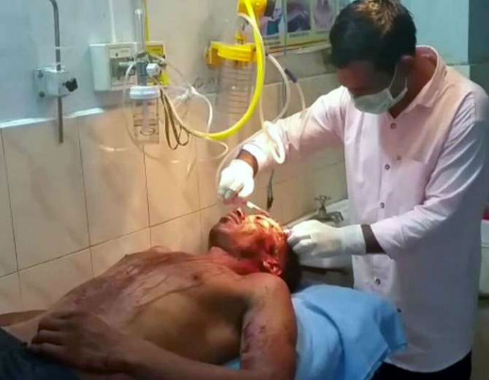 ਭੱਜਾ ਕੇ ਵਿਆਹ ਕਰਨ ਦੀ ਸੀ ਯੋਜਨਾ, ਲੜਕੀ ਦੇ ਭਰਾ ਨੂੰ ਪਤਾ ਚੱਲਿਆ ਤਾਂ ਕੀਤੀ ਇਹ ਹਾਲਤ