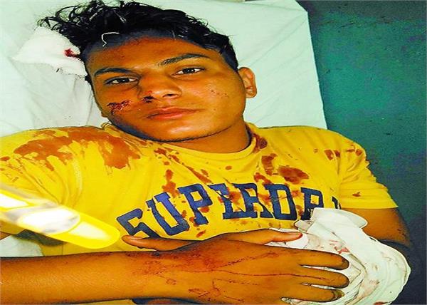 young people injured in bus collapse