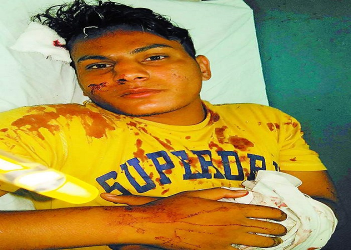 ਬੱਸ ਤੋਂ ਡਿੱਗਣ ਨਾਲ ਨੌਜਵਾਨ ਜ਼ਖ਼ਮੀ