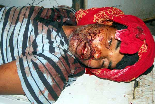 ਕਾਰ ਦੀ ਟੱਕਰ ਨਾਲ ਮੋਟਰਸਾਈਕਲ ਸਵਾਰ ਦੀ ਮੌਤ, ਇਕ ਜ਼ਖਮੀ