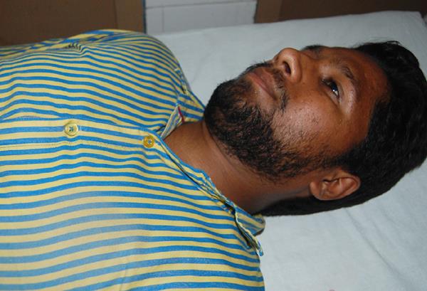 brother sister injured in motorcycle collision