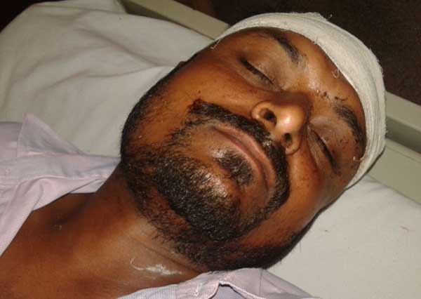 ਤੇਜ਼ ਰਫਤਾਰ ਕਾਰ ਦੀ ਟੱਕਰ ਨਾਲ ਮੋਟਰਸਾਈਕਲ ਸਵਾਰ ਜ਼ਖਮੀ