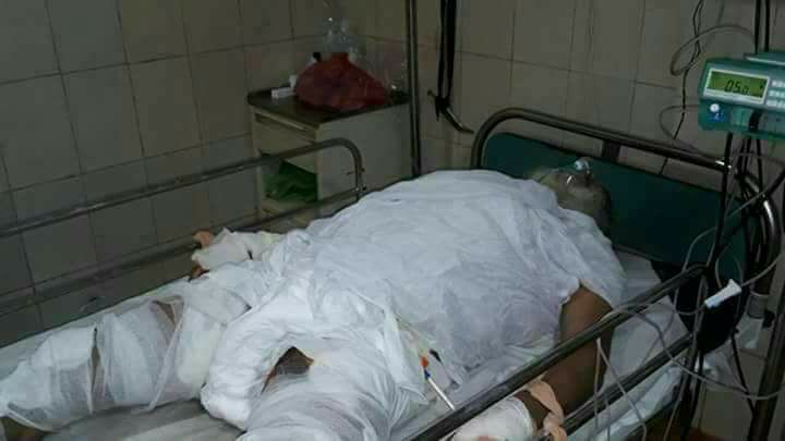 ਦਰਬਾਰ ਸਾਹਿਬ ਵਿਚ ਲੰਗਰ ਦੇ ਕੜਾਹੇ ''ਚ ਡਿੱਗੇ ਲਾਂਗਰੀ ਦਾ ਹਾਲ ਪੁੱਛਣ ਪਹੁੰਚੇ ਮਨਜੀਤ ਸਿੰਘ ਜੀ. ਕੇ.