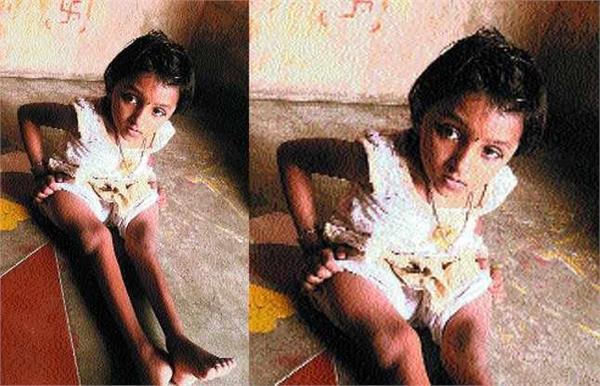 9 year old lakshmi  s 13 times broken bones