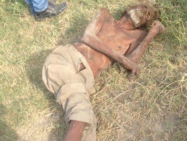 dead body of unidentified person