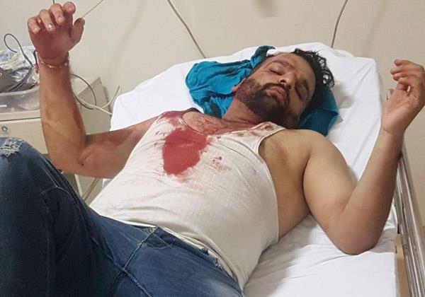 two parties were robbed of money in pune city