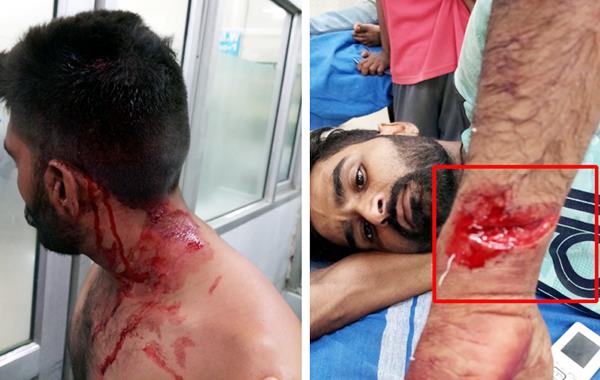 attacking the players to get the ground free to add to the drug addiction