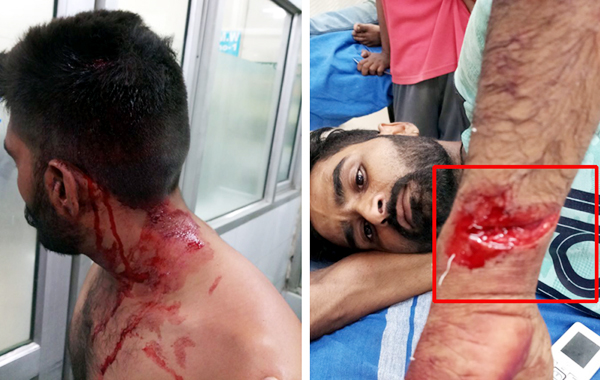 ਨਸ਼ਾ ਕਰਨ ਲਈ ਗਰਾਊਂਡ ਖਾਲੀ ਕਰਵਾਉਣ ਵਾਸਤੇ ਕੀਤਾ ਖਿਡਾਰੀਆਂ ''ਤੇ ਹਮਲਾ