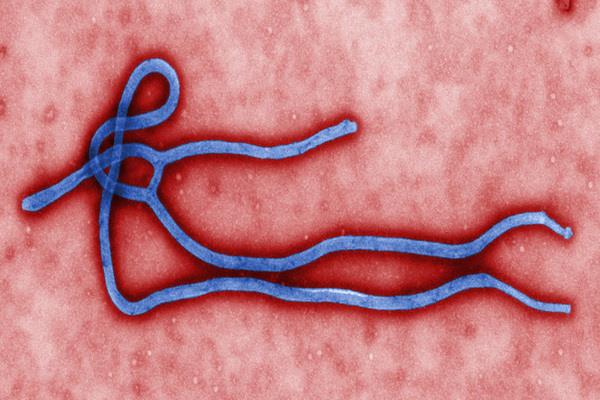 the virus can be left in a male sperm after 2 years of being ebola