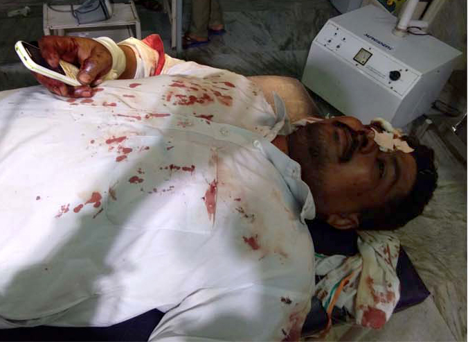 ਕਾਰ ਤੇ ਮੋਟਰਸਾਈਕਲ ਦੀ ਟੱਕਰ ''ਚ ਦੋ ਜ਼ਖਮੀ