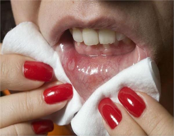 these home remedies will correct the mouthpieces in one day 