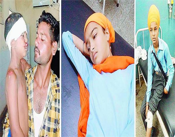 3 children have been injured due to deterioration of motorcycle balance