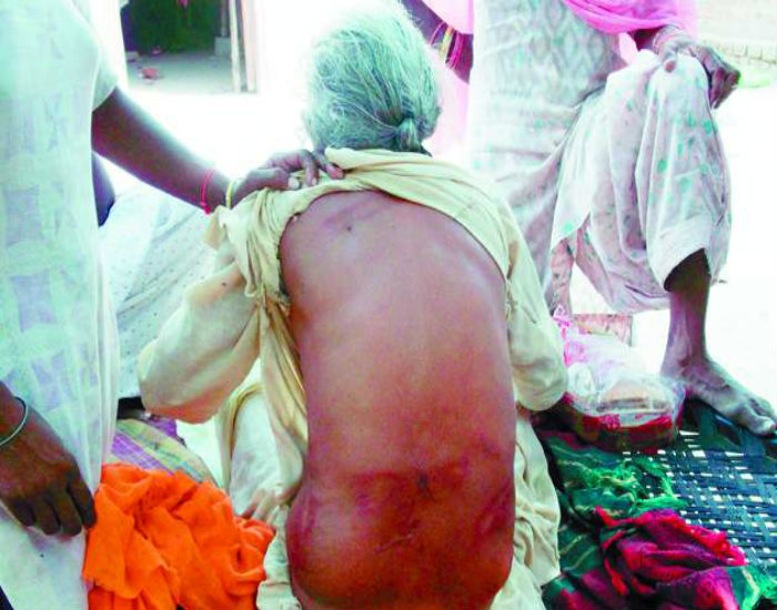 ਮਾਮਲਾ ਕਾਂਗਰਸੀ ਵਰਕਰਾਂ ਵੱਲੋਂ ਘਰ ਆ ਕੇ ਕੁੱਟਮਾਰ ਕਰਨ ਦਾ, ਅਕਾਲੀ ਵਰਕਰਾਂ ਨੇ ਪੁਲਸ ਤੋਂ ਕੀਤੀ ਇਨਸਾਫ ਦੀ ਮੰਗ