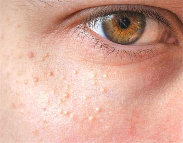 white faces on your face  keep these things specific
