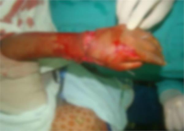 11 hours chopped hand added her complex operation