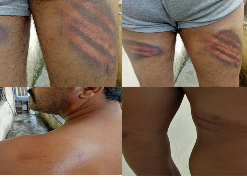 ਪੁਲਸ ਦੀ ਮਦਦ ਦਾ ਭੁਗਤਣਾ ਪਿਆ ਖਾਮਿਆਜ਼ਾ, ਸ਼ਰਾਬ ਠੇਕੇਦਾਰਾਂ ਨੇ ਦਿੱਤੀ ਰੌਂਗਟੇ ਖੜ੍ਹੇ ਕਰਨ ਵਾਲੀ ਸਜ਼ਾ