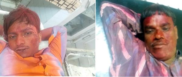 trolley scorpio collision  8 pilgrims injured