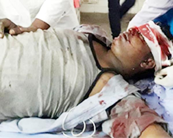 road accident