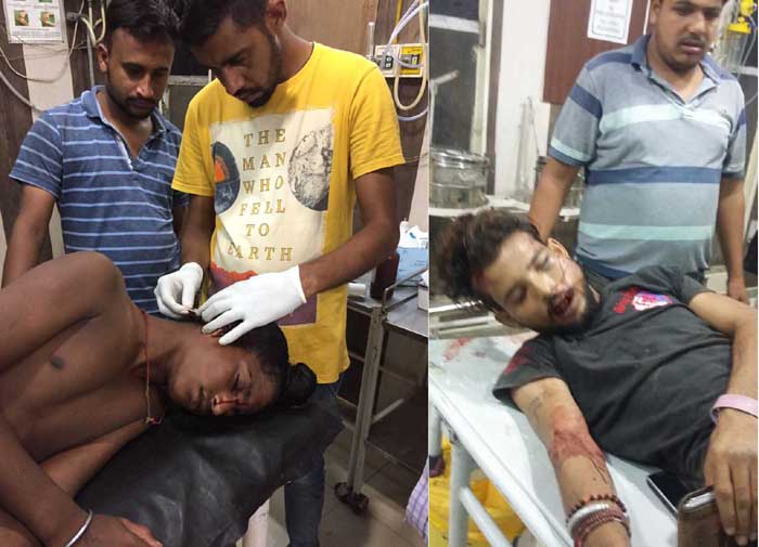 ਹਮਲੇ ''ਚ 2 ਜ਼ਖਮੀ