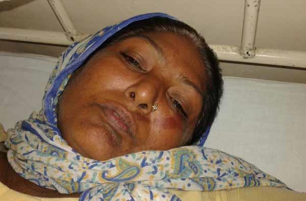 woman injured in a brutal assault on debris throwing