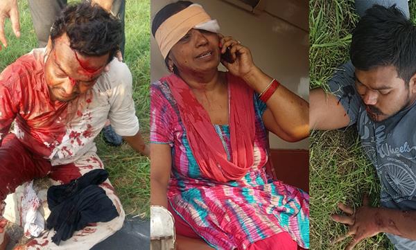 3 injured in road accident