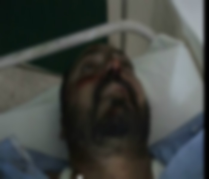 ਤੇਜ਼ ਰਫਤਾਰ ਟਰੱਕ ਦੀ ਚਪੇਟ ''ਚ ਆਉਣ ਨਾਲ ਮੋਟਰਸਾਇਕਲ ਸਵਾਰ ਵਿਅਕਤੀ ਦੀ ਦਰਦਨਾਕ ਮੌਤ (ਤਸਵੀਰਾਂ)