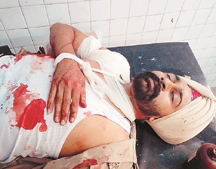 ਬੈਂਕ ਦੇ ਸੁਰੱਖਿਆ ਕਰਮਚਾਰੀ ਨੂੰ ਲੱਗੀ ਗੋਲੀ