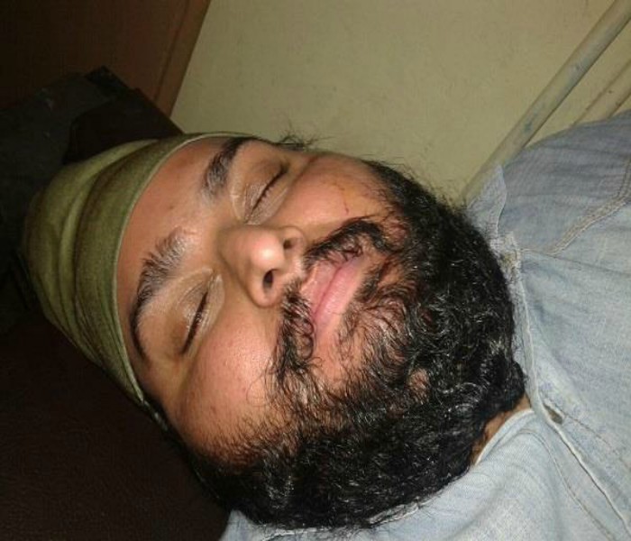 ਪੈਸਿਆਂ ਦੇ ਲੈਣ-ਦੇਣ ਨੂੰ ਲੈ ਕੇ ਭਿੜੇ ਦੋ ਧਿਰ, 3 ਜ਼ਖਮੀ   (ਤਸਵੀਰਾਂ)