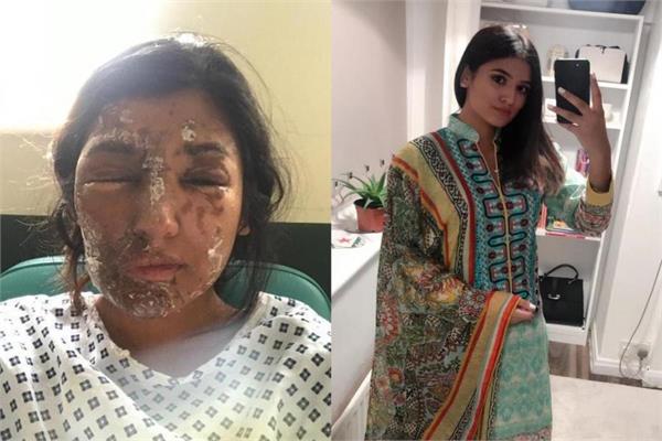 resham khan attack victim after her recovery