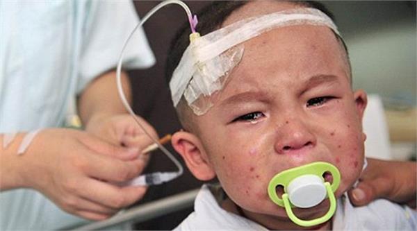 120 school children fell sick in china due to food poisoning