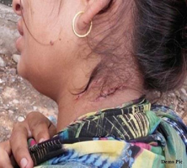 wife beaten by husband