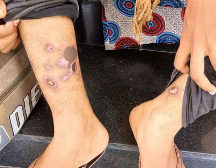 ਬੇਟੀ ਨੇ ਕੀਤੀ ਪੜ੍ਹਾਈ ਕਰਨ ਦੀ ਜਿੱਦ, ਪਰਿਵਾਰਕ ਮੈਬਰਾਂ ਨੇ ਹੱਥਾਂ-ਪੈਰਾਂ ਨੂੰ ਦਾਗ਼ਿਆ