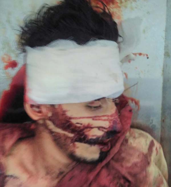 ਵਾਹਨ ਦੀ ਲਪੇਟ ''ਚ ਆਉਣ ਨਾਲ ਨੌਜਵਾਨ ਦੀ ਮੌਤ