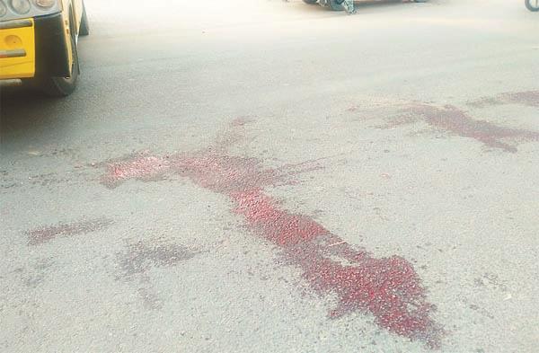 woman  s death due to canter undergoing  1 injury