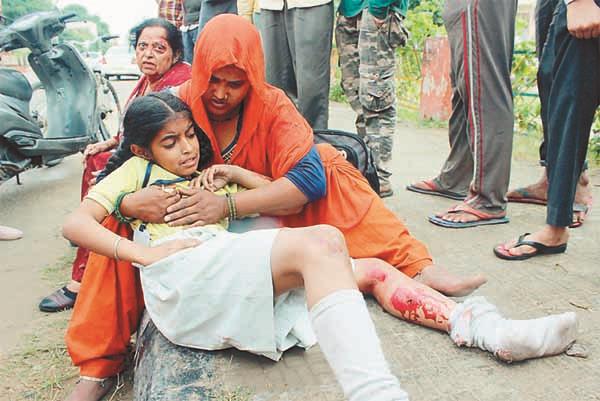 activa collide  broken legally also injured in the leg of the child