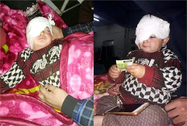 18 month old hiba jan  kashmir  s youngest pellet victim