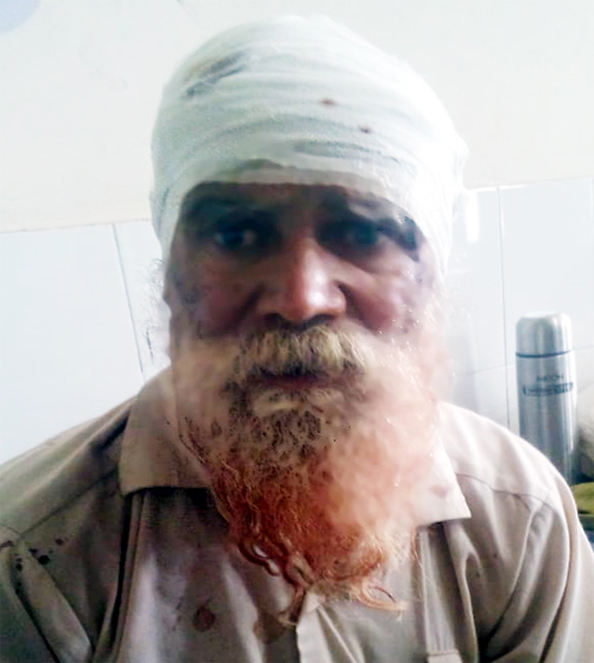 ਭਰਾ ਦੀ ਜਾਨ ਦਾ ਦੁਸ਼ਮਣ ਬਣਿਆ ਭਰਾ, ਕੀਤਾ ਹਮਲਾ