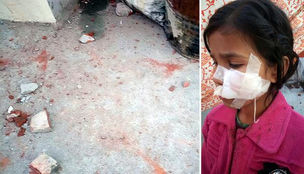 drugged young man stabbed with his colleagues  6 injured