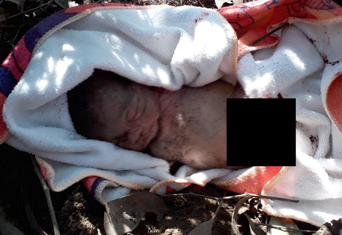 ਲਾਵਾਰਿਸ ਨਵਜੰਮੀ ਬੱਚੀ ਨੂੰ ਕੁੱਤਿਆਂ ਨੇ ਨੋਚਿਆ