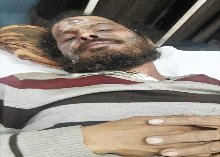 ਕਰੰਟ ਲੱਗਣ ਨਾਲ ਵਿਅਕਤੀ ਝੁਲਸਿਆ