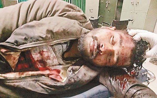 young injured seriously injured in a train derailed from ferozepur