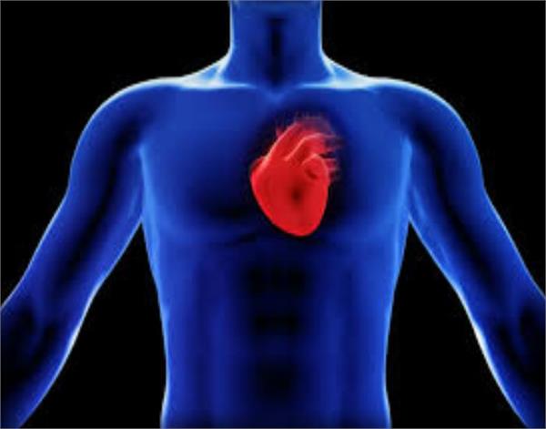 heart attack with sudden cardiac arrest