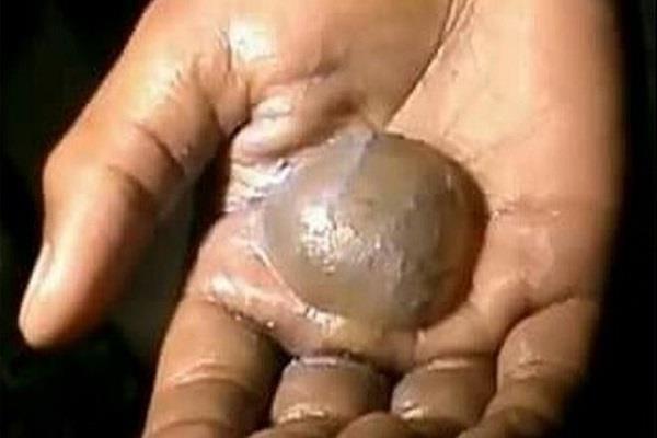 principal burnt students hand with candles