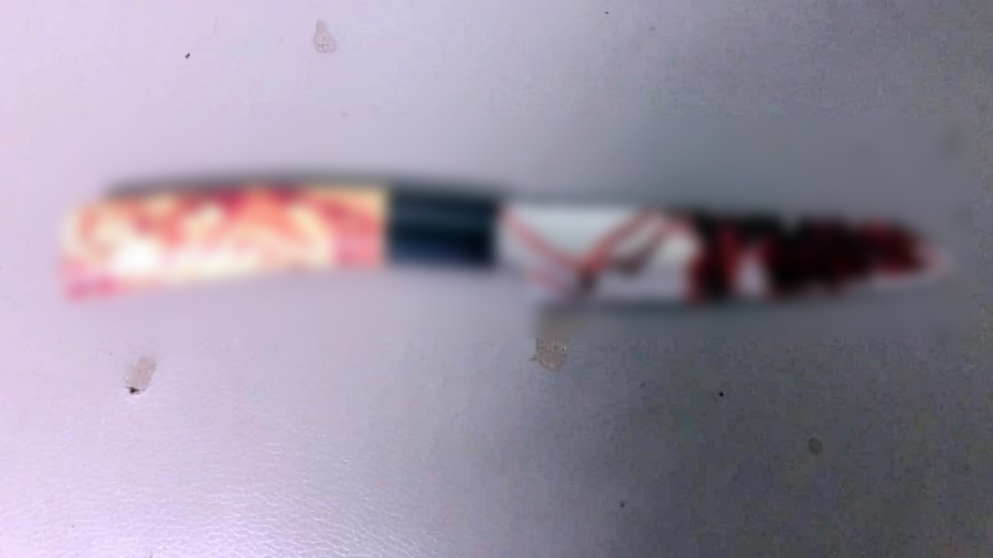 ਕਾਂਗੋ : ਅਣਪਛਾਤੇ ਹਮਲਾਵਰਾਂ ਨੇ ਹਸਪਤਾਲ ''ਚ ਮਰੀਜ਼ਾਂ ''ਤੇ ਕੀਤਾ ਚਾਕੂ ਨਾਲ ਹਮਲਾ