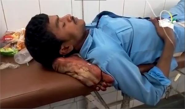 up government suspended doctors and nurse in jhansi medical college case